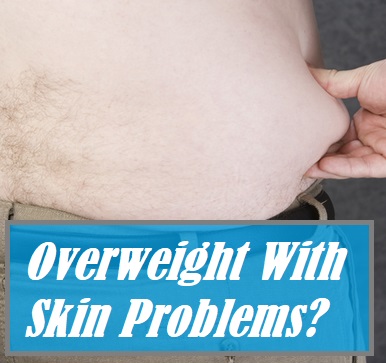 Skin Conditions For Obese People