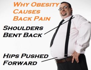 How Does Being Overweight Cause Back Pain